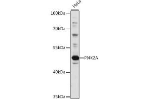 Western blot analysis of extracts of HeLa cells, using PI4K2A antibody (ABIN7269284) at 1:1000 dilution. (PI4K2A Antikörper  (AA 131-479))