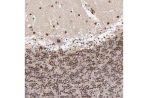 Immunohistochemical staining of human cerebellum with NCOR2 polyclonal antibody  shows strong moderate nuclear positivity in Purkinje cells, cells in molecular layer and cells in granular layer. (NCOR2 Antikörper)