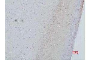 Immunohistochemistry (IHC) analysis of paraffin-embedded Rat Brain Tissue using CACNG2 Polyclonal Antibody. (Stargazin Antikörper)