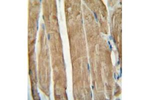 Immunohistochemistry analysis in formalin fixed and paraffin embedded human skeletal muscle reacted with PGAM2 Antibody (N-term) followed which was peroxidase conjugated to the secondary antibody and followed by DAB staining.