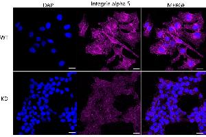 Immunocytochemical staining of HeLa cells using Integrin alpha 5 antibody (ABIN7799077), 1:1,000), Top panel: wild-type (WT), Bottom panal: Integrin alpha 5 shRNA knockdown (KD). (Rekombinanter ITGA5 Antikörper)