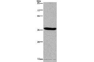 Western blot analysis of LO2 cell, using KCNK17 Polyclonal Antibody at dilution of 1:300