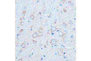Immunohistochemistry of paraffin-embedded mouse brain using LC3B Rabbit pAb (ABIN6129924 and ABIN6143474) at dilution of 1:100 (40x lens). (LC3B Antikörper)
