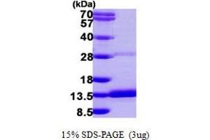 SDS-PAGE (SDS) image for Dynein, Light Chain, Roadblock Type 2 (DYNLRB2) (AA 1-96) protein (His tag) (ABIN667383)