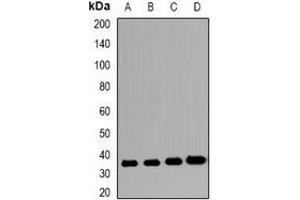 Western blot analysis of VSIG2 expression in LDL (A), PC3 (B), mouse stomach (C), rat stomach (D) whole cell lysates.