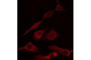 ABIN6275041 staining HuvEc cells by IF/ICC. (HSD11B1 Antikörper  (N-Term))