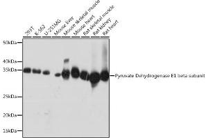 Western blot analysis of extracts of various cell lines, using Pyruvate Dehydrogenase E1 beta subunit Rabbit mAb (ABIN7269772) at 1:1000 dilution.