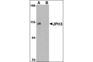 Western blot analysis of JPH3 in Daudi cell lysate with this product at 1 μg/ml in (A) the absence and (B) the presence of blocking peptide. (Junctophilin 3 Antikörper  (Center))