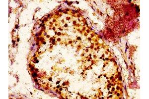 Immunohistochemistry (IHC) image for anti-RAB3 GTPase Activating Protein Subunit 1 (Catalytic) (RAB3GAP1) (AA 527-653), (Catalytic Subunit) antibody (ABIN7166993)