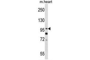 SULF2 Antibody (C-term) western blot analysis in mouse heart tissue lysates (35µg/lane).