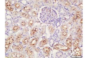 Immunohistochemistry (Paraffin-embedded Sections) (IHC (p)) image for anti-Caspase 12 (Gene/pseudogene) (CASP12) (AA 201-300) antibody (ABIN737736)