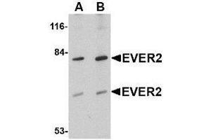 Western blot analysis of EVER2 in Jurkat cell lysate with AP30323PU-N EVER2 antibody at (A) 1 and (B) 2 μg/ml.