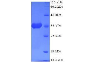 SDS-PAGE (SDS) image for ADP-Ribosylation Factor 6 (ARF6) (AA 1-175), (full length) protein (His-SUMO Tag) (ABIN5709075)