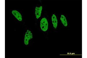 Immunofluorescence (IF) image for anti-E1A Binding Protein P300 (EP300) (AA 731-830) antibody (ABIN560748)