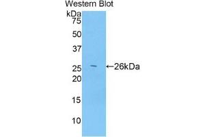 Western Blotting (WB) image for anti-ADAM Metallopeptidase with thrombospondin Type 1 Motif, 12 (ADAMTS12) (AA 1318-1538) antibody (ABIN7438883)