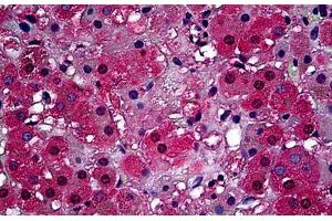 Immunohistochemistry (Formalin-fixed Paraffin-embedded Sections) (IHC (fp)) image for anti-ATP-Binding Cassette, Sub-Family B (MDR/TAP), Member 1 (ABCB1) (Extracellular) antibody (ABIN2450190)