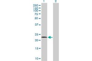 Western Blot analysis of RGS1 expression in transfected 293T cell line by RGS1 MaxPab polyclonal antibody.