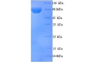 SDS-PAGE (SDS) image for Interferon-Induced, Double-Stranded RNA-Activated Protein Kinase (E2AK2) (AA 2-551) protein (His tag) (ABIN5713420) (E2AK2/PKR Protein (AA 2-551) (His tag))