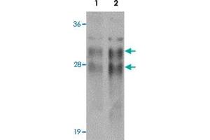 Western blot analysis of CRISP2 in human testis tissue lysate with CRISP2 polyclonal antibody  at (1) 0.