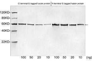 Western blot analysis of E tagged fusion proteins expressed in E.