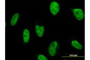 Immunofluorescence of monoclonal antibody to MPG on HeLa cell. (MPG Antikörper  (AA 1-90))