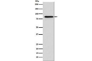 Western blot analysis of Gelsolin expression in A431 cell lysate.
