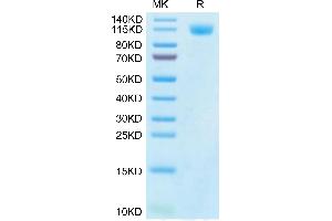 SARS-CoV-2 Spike S1 (Gamma P. (SARS-CoV-2 Spike S1 Protein (P.1 - gamma) (His tag))