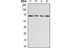 Western blot analysis of Ribophorin-1 expression in HepG2 (A), SKOV3 (B), mouse liver (C), rat liver (D) whole cell lysates. (RPN1 Antikörper)