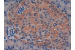 Immunohistochemistry (IHC) image for anti-R-Spondin 1 (RSPO1) (AA 136-262) antibody (ABIN7437200)
