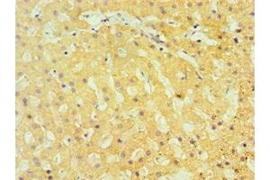 Immunohistochemistry of paraffin-embedded human liver tissue using ABIN7172813 at dilution of 1:100 (TBRG1 Antikörper  (AA 22-150))