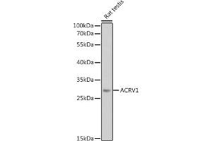 Western blot analysis of extracts of Rat testis, using  antibody (ABIN6129184, ABIN6136452, ABIN6136453 and ABIN6224123) at 1:1000 dilution. (ACRV1 Antikörper  (AA 22-265))