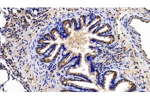Detection of EPCR in Rat Lung Tissue using Polyclonal Antibody to Endothelial protein C receptor (EPCR) (PROCR Antikörper  (AA 59-217))