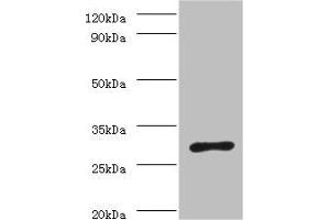 Western blot All lanes: ureA antibody at 2 μg/mL + Helicobacter pylori bacteria liquid Secondary Goat polyclonal to rabbit IgG at 1/10000 dilution Predicted band size: 27 kDa Observed band size: 27 kDa (Urea (AA 1-238) Antikörper)