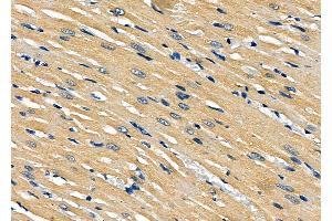 ABIN6261126 and ABIN6277912 at 1/100 staining Rat heart tissue by IHC-P. (CXCR1 Antikörper  (N-Term))