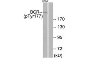Western blot analysis of extracts from K562 cells, using Bcr (Phospho-Tyr177) Antibody. (BCR Antikörper  (pTyr177))