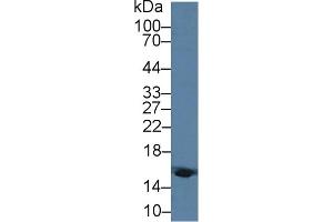 Detection of HBd in Human Blood Cells lysate using Polyclonal Antibody to Hemoglobin Delta (HBd) (HBd Antikörper  (AA 1-143))