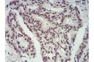 Immunohistochemistry (IHC) image for anti-Chromobox Homolog 4 (CBX4) (AA 397-514) antibody (ABIN5883842) (CBX4 Antikörper  (AA 397-514))