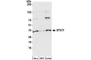 Western Blotting (WB) image for anti-Syntaxin 17 (STX17) (AA 150-200) antibody (ABIN7449258)