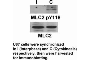 Western Blotting (WB) image for anti-Myosin Regulatory Light Chain 2, Smooth Muscle Isoform (MYL9) (pTyr118) antibody (ABIN7138917)