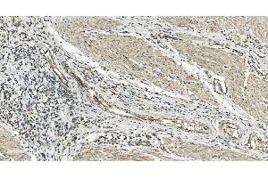 IHC analysis of FLCN using anti-FLCN antibody (ABIN7602491).