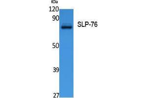 Western Blotting (WB) image for anti-Lymphocyte Cytosolic Protein 2 (SH2 Domain Containing Leukocyte Protein of 76kDa) (LCP2) (Internal Region) antibody (ABIN6282745)