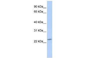 RBPMS2 antibody used at 1 ug/ml to detect target protein. (RBPMS2 Antikörper  (Middle Region))