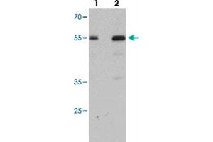 Western blot analysis of SDPR in HeLa cell lysate with SDPR polyclonal antibody  at (lane 1) 1 and (lane 2) 2 ug/mL. (SDPR Antikörper  (N-Term))