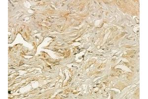 ABIN6258113 and ABIN6273354 at 1/100 staining human testicular cancer by IHC-P.
