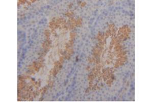 IHC-P analysis of Mouse Testis Tissue, with DAB staining. (ITLN1/Omentin Antikörper  (AA 28-270))