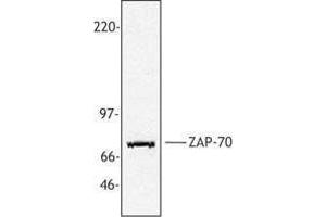 Western Blotting (WB) image for anti-zeta-Chain (TCR) Associated Protein Kinase 70kDa (ZAP70) antibody (ABIN2665463) (ZAP70 Antikörper)