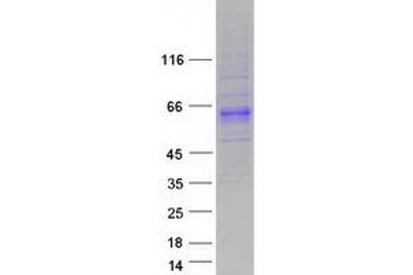 ACPL2 Protein (Transcript Variant 2) (Myc-DYKDDDDK Tag)