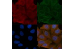 TST Mouse Monoclonal Antibody staining Hela cells by IF/ICC. (TST Antikörper)
