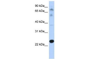 CHIC2 antibody used at 1 ug/ml to detect target protein. (CHIC2 Antikörper  (N-Term))