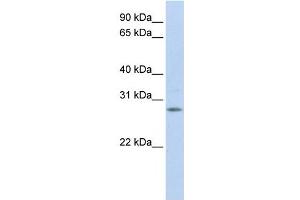 IGFBP4 antibody used at 1 ug/ml to detect target protein.